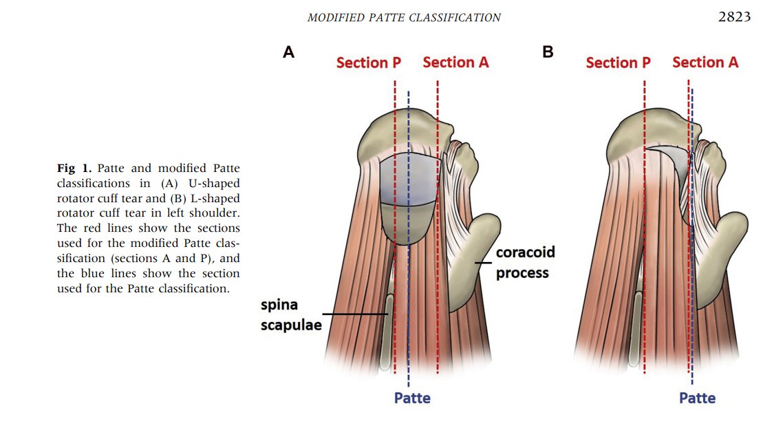 Sameer Raniga On Twitter In The Patte Method The Coronal Section On