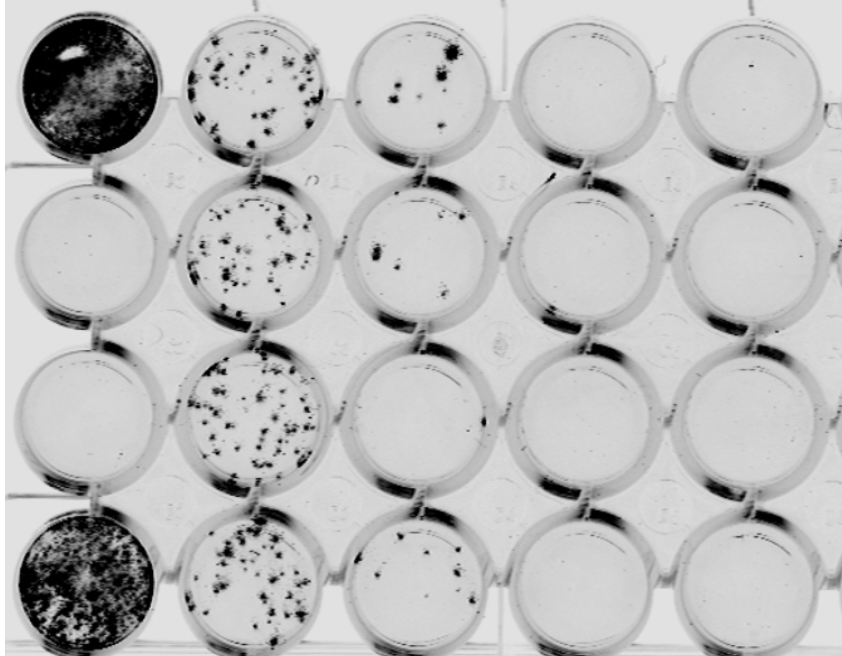 lab_jouvenet's tweet photo. First titrations of 🦇 flaviviruses by in-cell Western. Good news, the pan-flavi anti-Env allowed the titration of all bat flaviviruses, even the ones belonging to the ‘no known vector’ group 🥳
@morganecns @aicher_sophie https://t.co/uGnfkwyczy