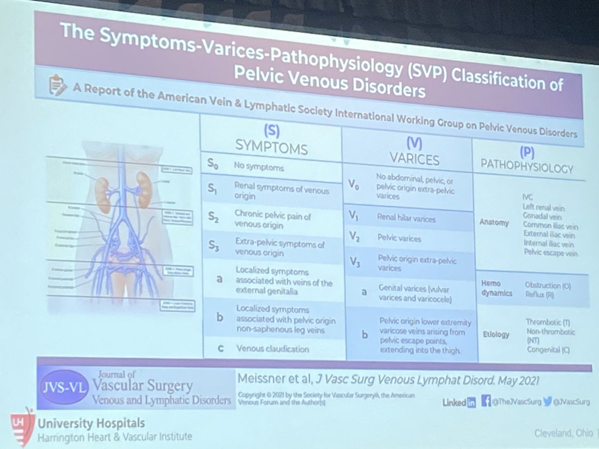 .<a href="/KaremHarthMD/">Karem Harth, MD MHS</a> reviews core elements of duplex protocols for assessment of pelvic venous insufficiency <a href="/HarringtonHVI/">UH Harrington Heart & Vascular Institute</a> <a href="/UHVascular/">UH Vascular Surgery</a>