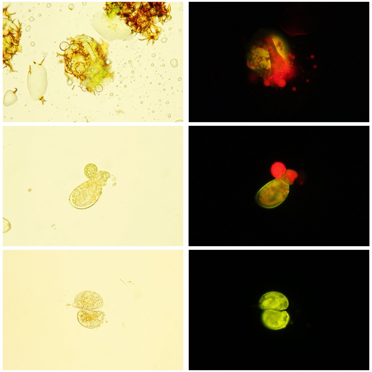 Li-Yaung Kuo (@kuofernlab) on Twitter photo For fern lab joint meeting this time <a href="/TFRI/">follow helpers_gang </a>, I prepared two presentations about our latest phylogeny of Lomariopsidaceae, including evolution of chloroplast-bearing spores in this fern family. The morning after #FernFriday <a href="/tzutongkao/">Tzu-Tong Kao</a> <a href="/xiepeijun6/">Annie</a> For fern lab joint meeting this time <a href="/TFRI/">follow helpers_gang </a>, I prepared two presentations about our latest phylogeny of Lomariopsidaceae, including evolution of chloroplast-bearing spores in this fern family. The morning after #FernFriday <a href="/tzutongkao/">Tzu-Tong Kao</a> <a href="/xiepeijun6/">Annie</a>