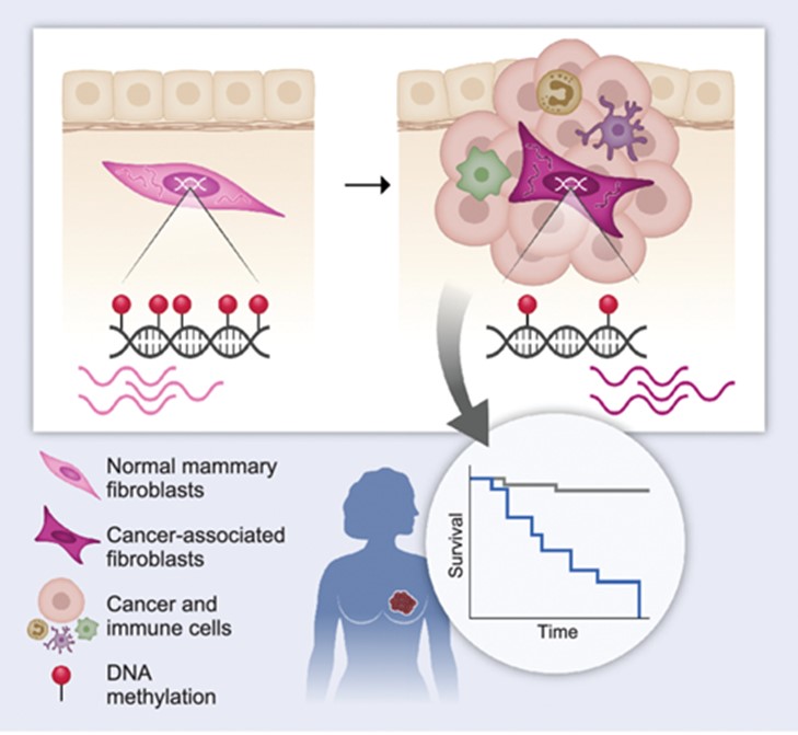 If you’re going to the #AACR23 session “A Road Less Traveled: Where Do CAFs Come from and Where Do They Go?”, be sure to read two recent papers on the topic from session chair, <a href="/shouval/">Ruth Shouval</a>, one of our new Senior Editors!
bit.ly/3KYT2Jj
bit.ly/43BFrih