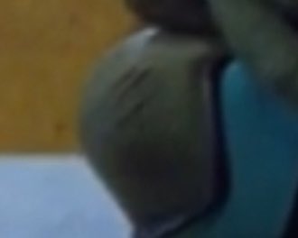 Bellaboop2164's tweet photo. Is that a knee scar or am I going insane? https://t.co/yhqmp4qBx1