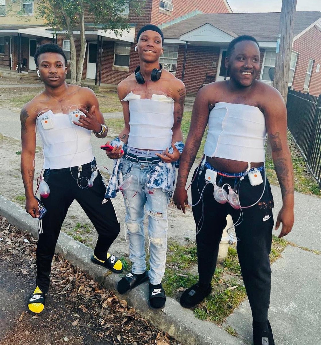 tyliq21_'s tweet photo. 1 YEAR DOWN… FOREVER TO GO🏳️⚧️💕🫶🏽 #blackftmoftiktok #blackftm🏳️⚧️ #ftmtransgender #topsurgery #ftm #fypシ #foryourpride #ftmtopsurgery #selfmademan #DMV #lgbt #greenscreen #transgenderoftiktok https://t.co/D9bpMNgIGq