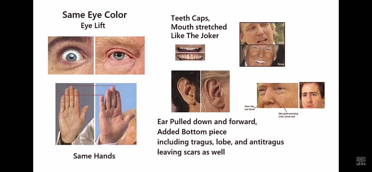 ArmchairPriest's tweet photo. @iluminatibot The #SignatureReduction program being outted 2 years ago was a cover up media wise to make it all an under the rug joke. Agents have hand sleeves, ears wraps, bionic eyes etc.
Donald has been a / has had a decoy spy let alone since โ84 under the CIA driven reagan n bush admins. https://t.co/bZjGaNt69g