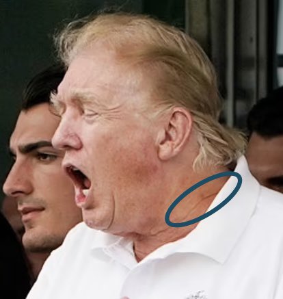 ArmchairPriest's tweet photo. @iluminatibot The #SignatureReduction program being outted 2 years ago was a cover up media wise to make it all an under the rug joke. Agents have hand sleeves, ears wraps, bionic eyes etc.
Donald has been a / has had a decoy spy let alone since โ84 under the CIA driven reagan n bush admins. https://t.co/bZjGaNt69g