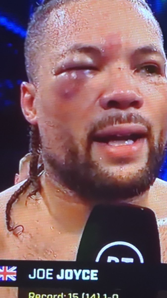 bbmworld2013's tweet photo. Un lucky to JJ he gave all he had #JoeJoyce https://t.co/OOlChWwJ05 https://t.co/76oN6NuPQQ