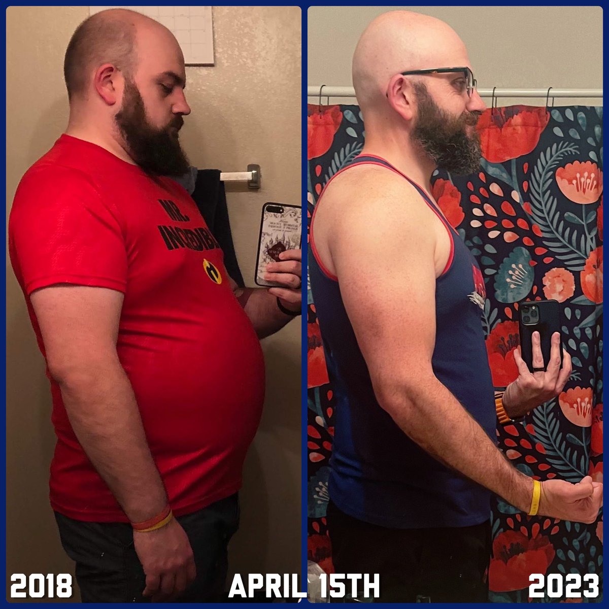 MarcVibbert's tweet photo. Five Years Progress 💪🏼
⠀
#AndyDwyerDiet #WeightLossTransformation #WeightLossJourney #WeightLoss #muscletoning #FiveYears https://t.co/Zsl4pwA9LQ