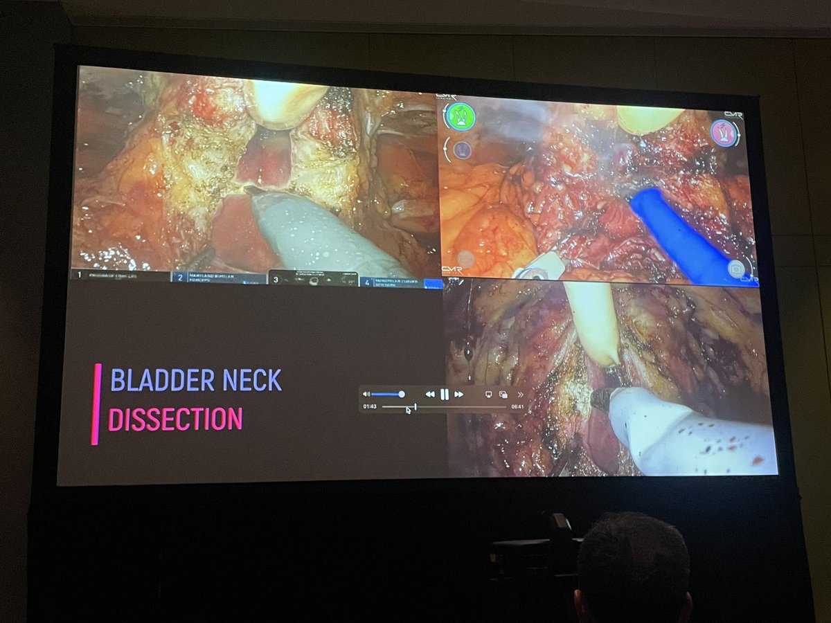 GyGUrologia's tweet photo. Comparison of the 3 urological robots (Da Vinci, Hugo and Versius) by Dr Rocco #AUA23 https://t.co/FCLusJGDoo