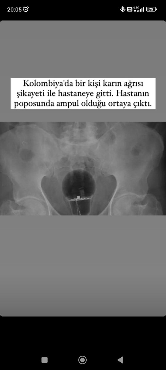 21 yıldır türkiye