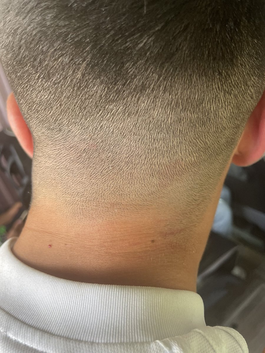 XemaVcf's tweet photo. Quiero declarar una vez mas si no ha quedado claro que soy inocente, no he hecho absolutamente nada, y los que estaba ahi en la grada conmigo lo han visto, estas son las lesiones que me han hecho estos “profesionales” y espero que en las camaras se muestre todo lo demás https://t.co/GxAz5x8Zz3