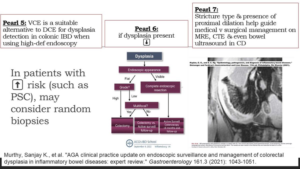 ScopingSundays's tweet photo. Missed out on the🔥🔥🔥#ScopingSundays discussion this past weekend on “Endoscopy in #IBD”?

Check out the #ScopingSummary from the interactive discussion led by @KDeFelice_IBD, @BenClement_MD &amp; @APNDMD !

Special thanks to @APNDMD for the summary! https://t.co/Lmsjy5d7EX
