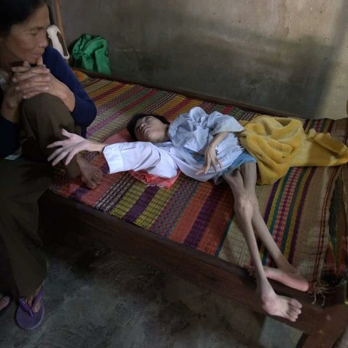 nguyen_p_quemai's tweet image. Today, 30 April 2023 marks the 48th anniversary of the end of the Việt Nam War. Yet the war still goes on for millions of innocent civilians in Việt Nam, Laos and Cambodia. I continue to call for compensation and justice for victims of Agent Orange
nytimes.com/2021/04/30/opi…