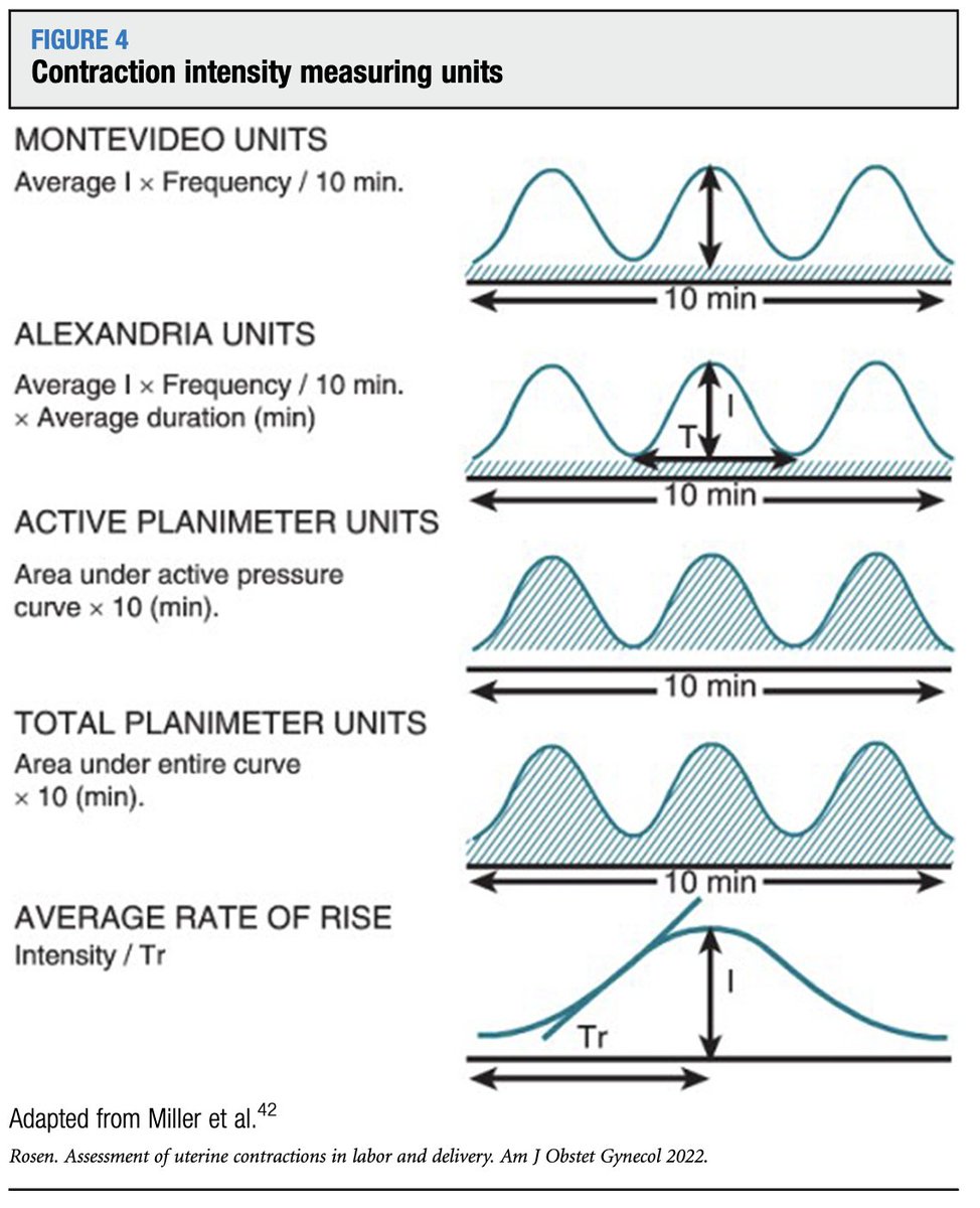 AJOG Expert Review in Labor:  Monitoring uterine contractions during labor: current challenges and future directions - Contraction intensity measurement units ow.ly/ol5Y50NOQyY
