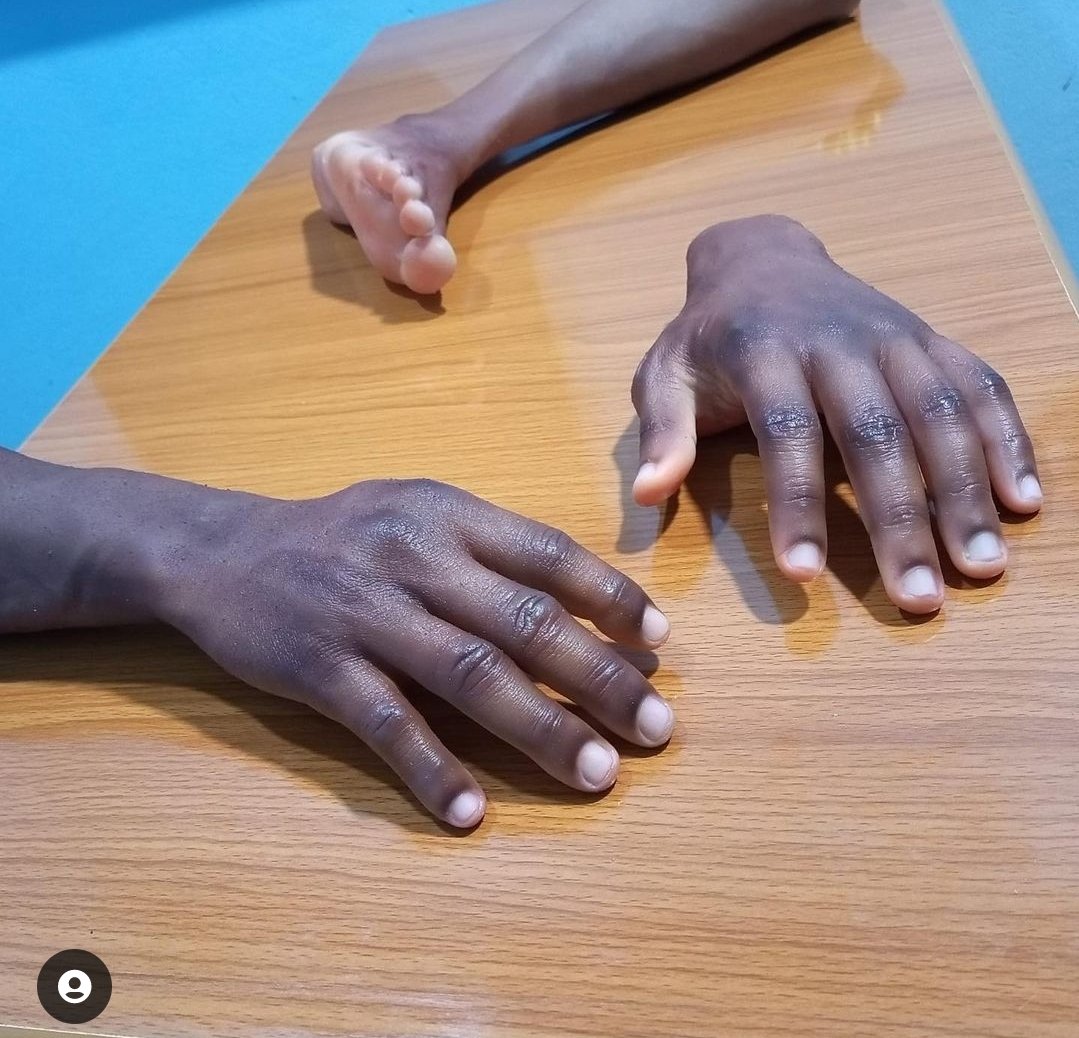 daddyowenmusic's tweet photo. I am really impressed by ths Nigerian sculptor John Amanam, He is the first African to produce hyper realistic prosthesis for Africans! Ths is a big win in the disability world! I have to look for ways on how we can partner and help so many PWDs in Kenya. 
@MalaikaDF 
@JohnAmanam21