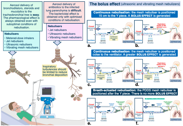 Aerosolised antibiotics in critical care <a href="/yourICM/">Intensive Care Medicine</a> 
➡️link.springer.com/article/10.100…