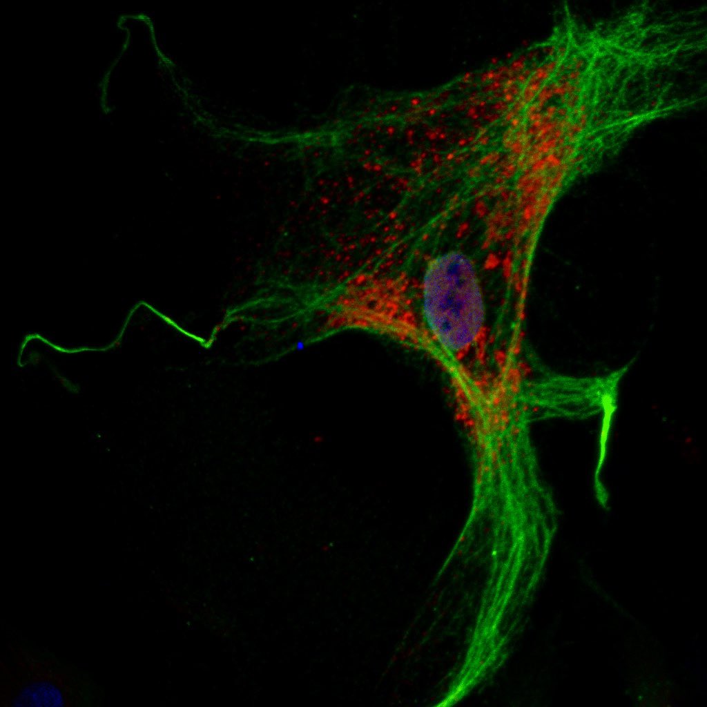 Tal Benjamin Zukerman (@talbenzuk) on Twitter photo A tale of a cell..
<a href="/RIlouz/">Ronit Ilouz</a> lab.
#Microscopy #Biology #immunofluorescence #ifstaining #fluorescence A tale of a cell..
<a href="/RIlouz/">Ronit Ilouz</a> lab.
#Microscopy #Biology #immunofluorescence #ifstaining #fluorescence