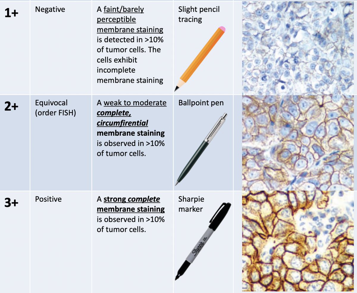 NalanYurtsever1's tweet image. Thank you @KurtSchaberg for making HER2 staining so easy and fun for us #pathology #boardreview