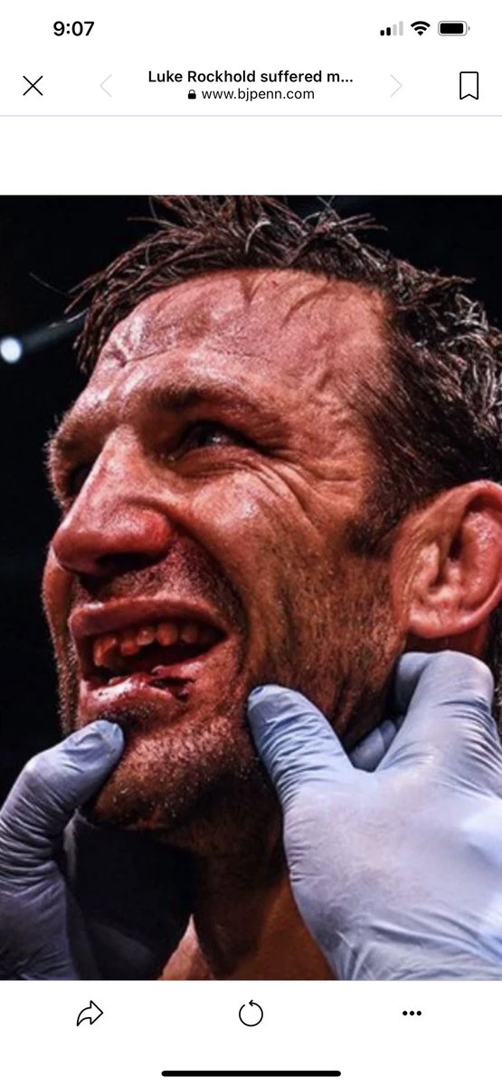 I wonder who made his mouthguard, and if this could have been prevented?