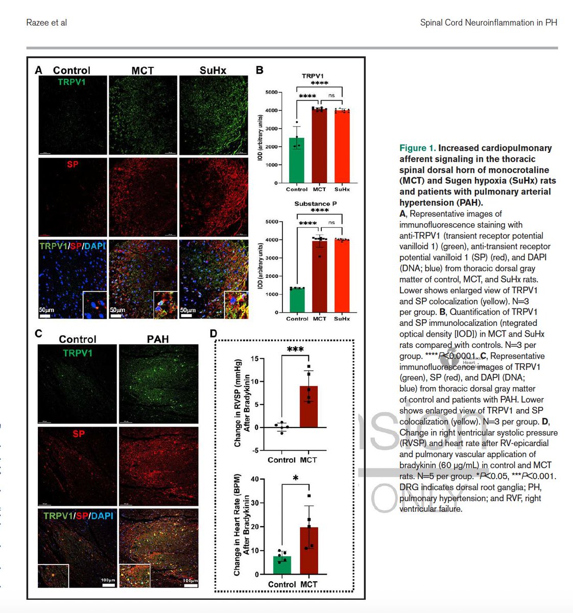 SobanUmar's tweet photo. Thrilled to share our latest findings on Cardiopulmonary Afferent Signaling and Thoracic Spinal Cord Neuroinflammation in preclinical and clinical PH published in @HyperAHA 

https://t.co/vHz9RlgpsZ

Outstanding thesis work 👏 by my @uclamcip PhD student @asifrazee !!! https://t.co/9Z4IaEz6Mz