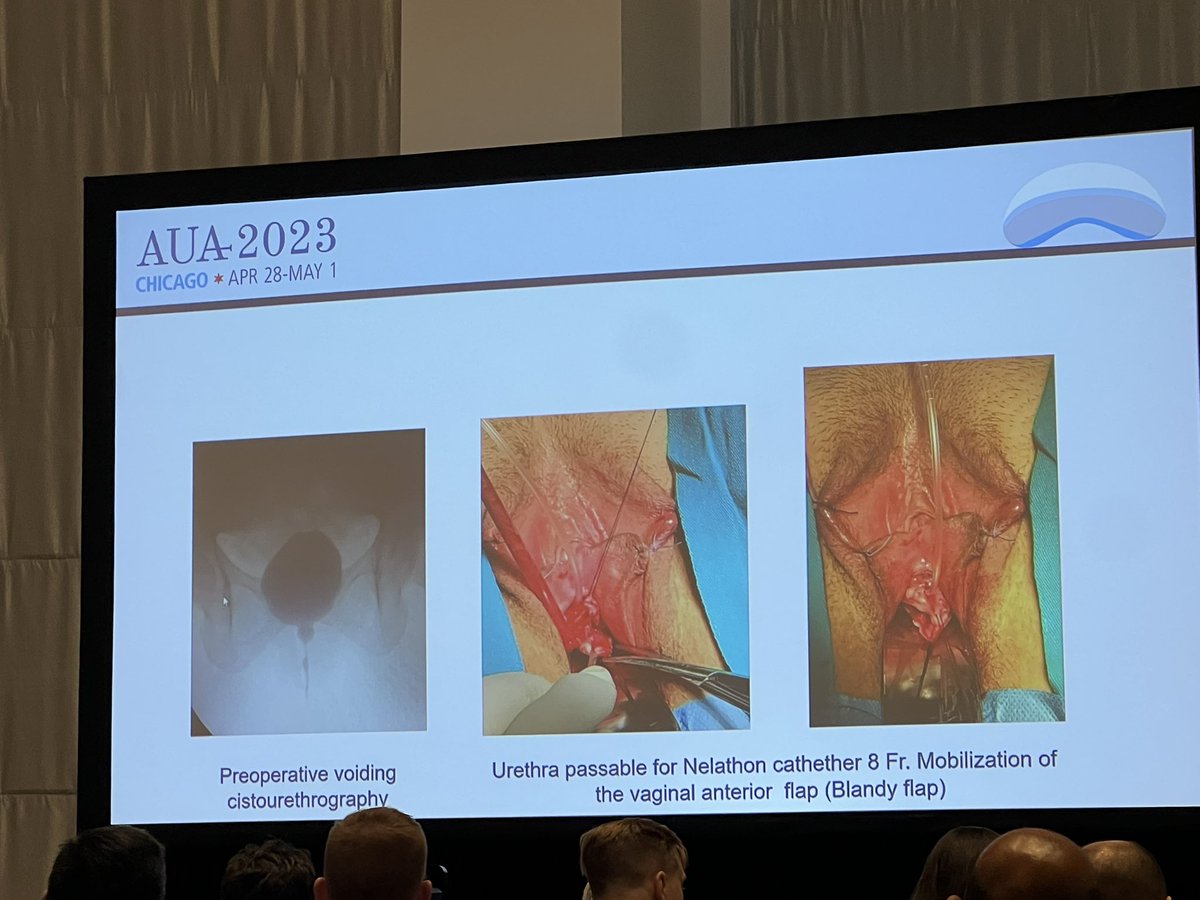 Very engaging and friendly debate on management strategies for female urethral disease from <a href="/TamsinGreenwel1/">Tamsin Greenwell</a> <a href="/AmandaSJChung/">Amanda Chung</a> Dr Ginsburg, and Dr Bizic!  #AUA2023