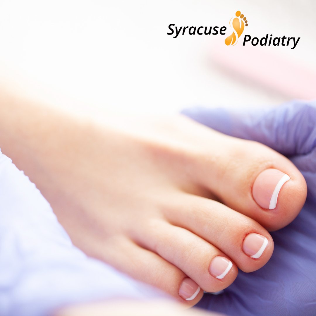 SyracuseFeet's tweet photo. Did you know that diabetic nerve damage can put you at a higher risk for foot and ankle problems? Keep your feet healthy and safe by scheduling an annual podiatry visit with us today! https://t.co/BnQ5IddulE https://t.co/YiNRPbKVCv