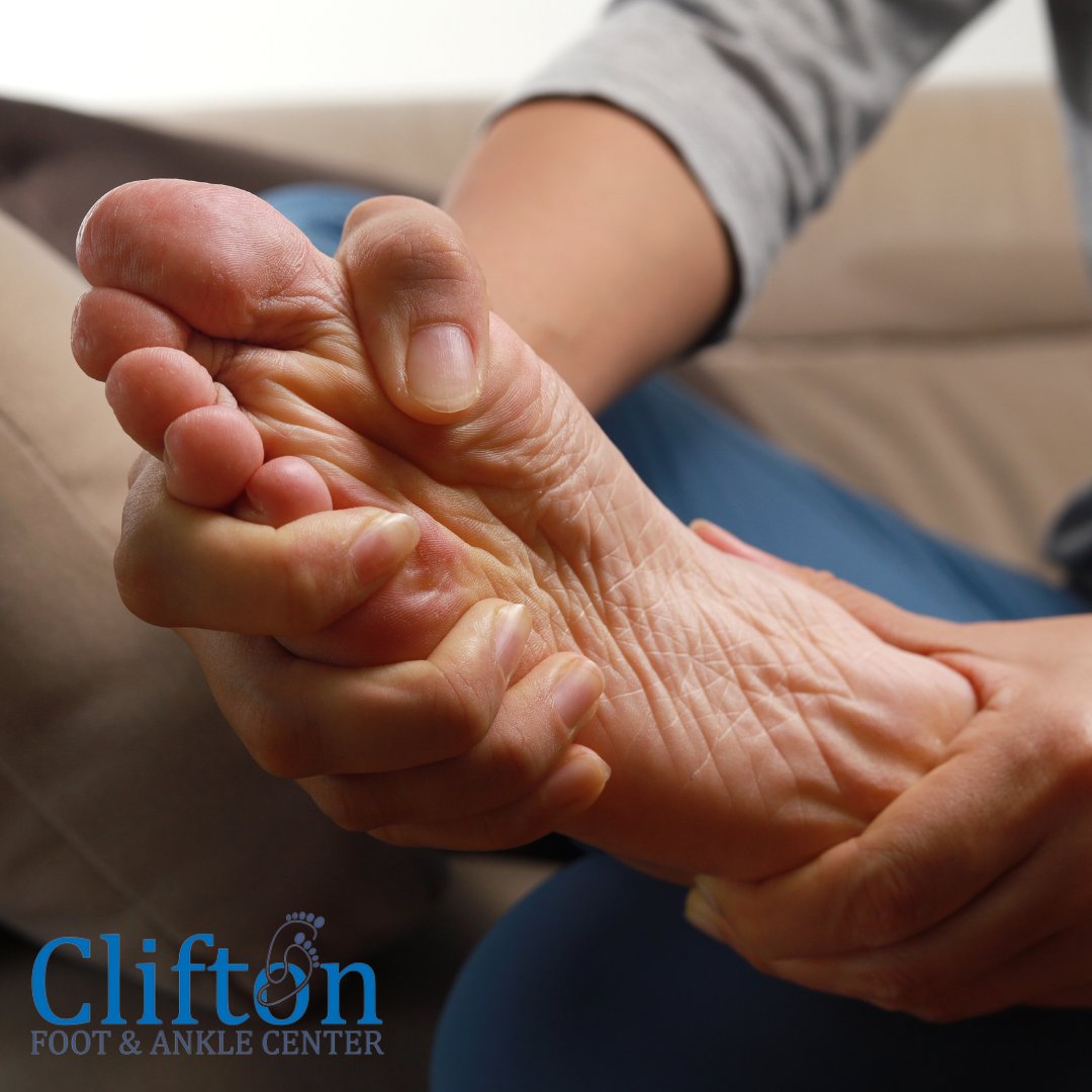 CliftonFoot's tweet photo. Are you feeling pain between your toes or on the ball of your foot? You could have a neuroma! Learn some at-home treatments for neuromas by visiting the link: https://t.co/16TyTn3ay6 https://t.co/KxbVxYhXJV