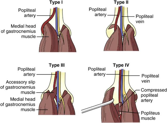 Necio Lizola MD (@renelizola) on Twitter photo 