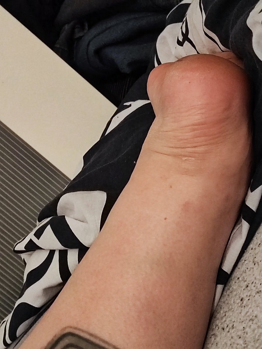 RoseColeman36's tweet image. #WhitePepoling #Fatankles #Whut #whiteboy #Germanmen #hell