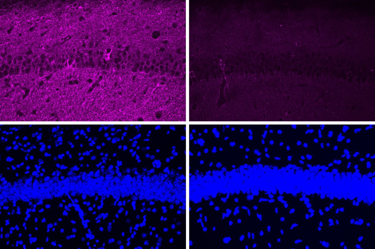 MIT's tweet photo. MIT neuroscientists have found a way to reverse neurodegeneration and other symptoms of Alzheimer’s disease by interfering with an enzyme that is typically overactive in the brains of Alzheimer’s patients. https://t.co/McyM1ZDbxs https://t.co/z4dP3VBZ8w