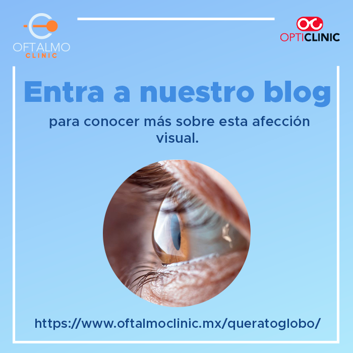 AVisionMetepec's tweet photo. Si tienes antecedentes familiares, es importante que consultes a un oftalmólogo. 👨‍⚕️👩‍⚕️ La prevención y el diagnóstico temprano son clave para mantener una buena salud ocular. 🙌

#Queratocono #SaludOcular #YoSoyOftalmoclinic #YoSoyOpticlinic #Oftalmoclinic #SaludVisual #Vista https://t.co/5Tj2xyBEev