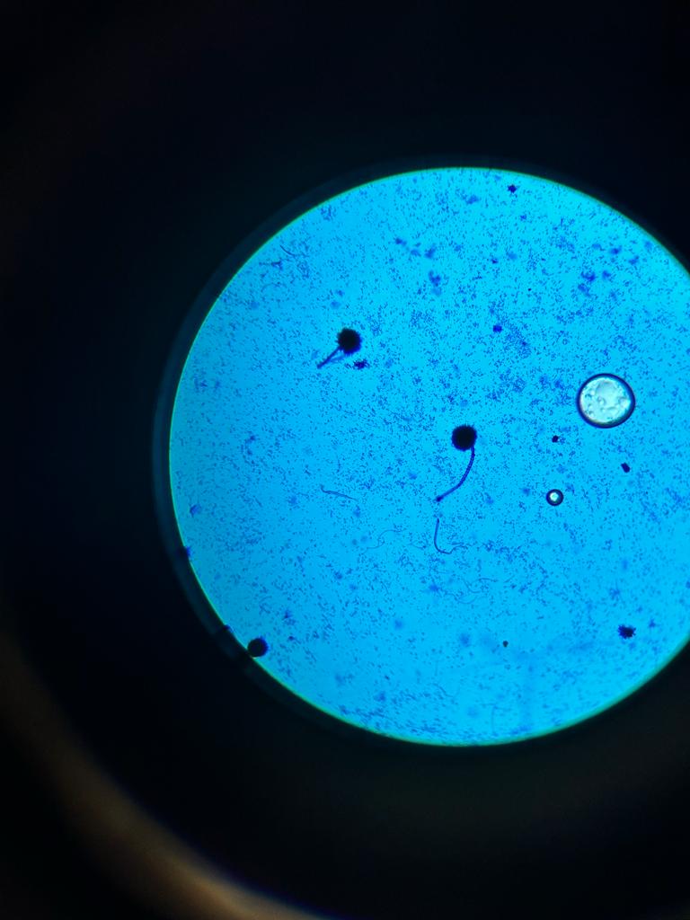 NUTRIBIOLOGOS's tweet photo. Montando hongos en las placas con el químico azul de lactofenol para poder visualizarlo en el microscopio https://t.co/FmCKzrj97n