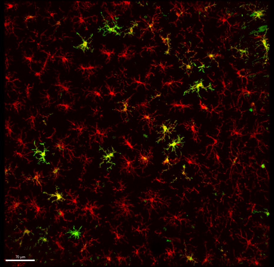 Happy fluorescence Friday! Found some antigen-presenting microglia in aging CA3 - stay tuned for alcohol effects