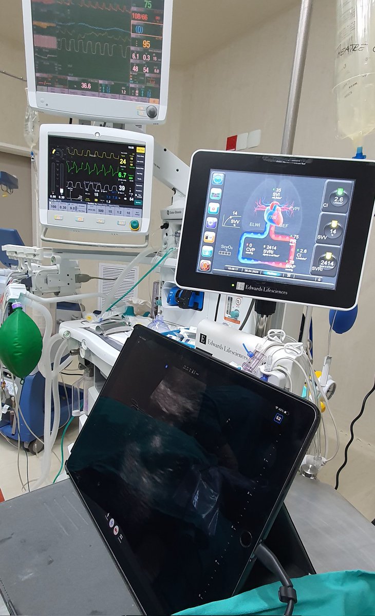 Charlé Steyl (@steylcharle) on Twitter photo Makes me very happy when my Butterfly IQ can be used during a liver resection! <a href="/zebra_medical/">ZEBRAMEDICAL</a> <a href="/ButterflyNetInc/">Butterfly Network</a> Makes me very happy when my Butterfly IQ can be used during a liver resection! <a href="/zebra_medical/">ZEBRAMEDICAL</a> <a href="/ButterflyNetInc/">Butterfly Network</a>