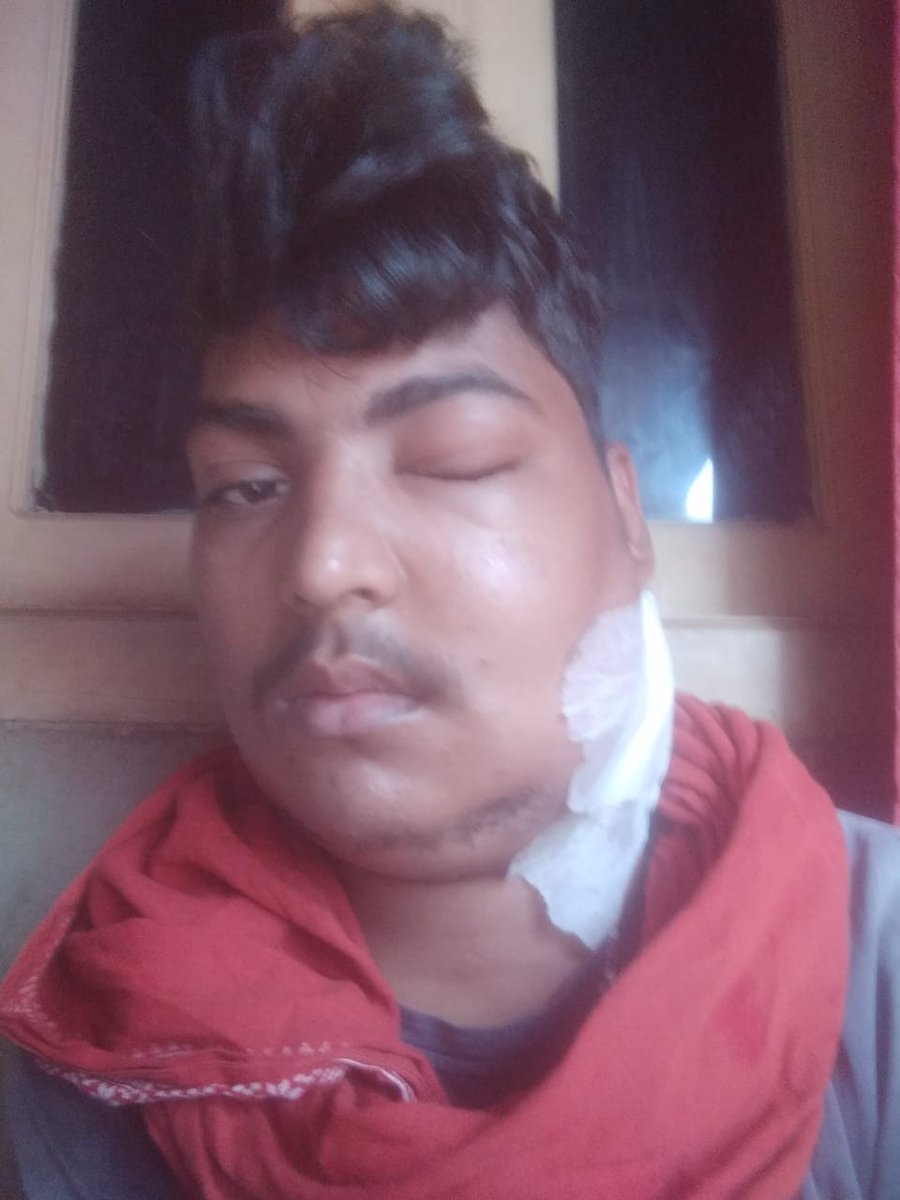 animeshamrit's tweet photo. #Manish_Kumar, a Resident of #Sitamarhi,#Bihar, is a #Cancer_Patient who is unable to get proper treatment due to poverty. Please help this poor man. Contact Mobile Number is 7065674840.🌹🙏
@ketto @milaapdotorg @ImpactGuru @impactguru_in @SonuSood @SoodFoundation @tatatrusts https://t.co/YASm07rsYT
