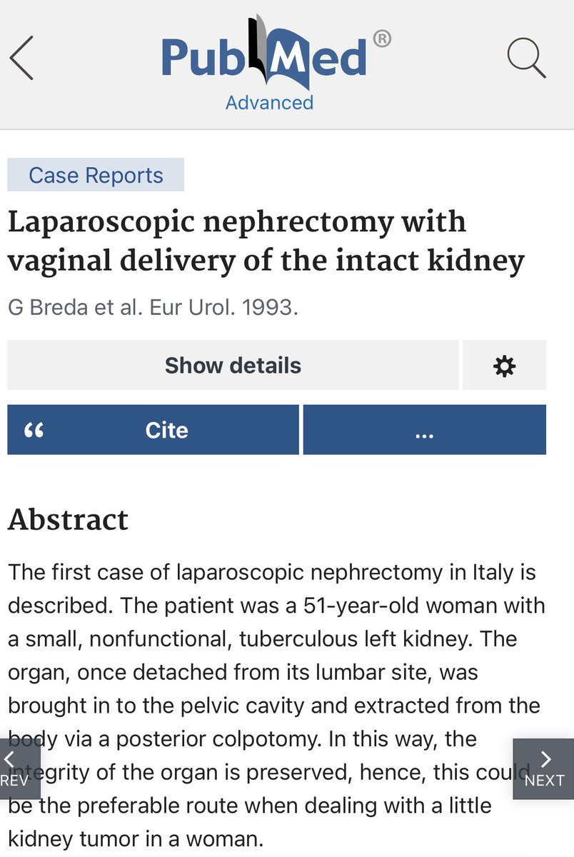 Thirty year anniversary of the FIRST ever reported transvaginal #laparoscopic #nephrectomy extraction by one of the true #pioneers of #laparoscopy and mentor of my life@guglielmobreda. Proud of my FATHER!