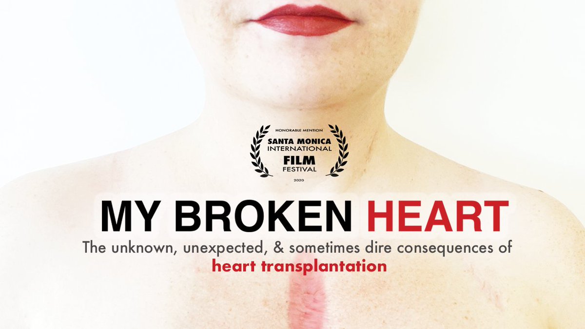 HeartLifeCanada's tweet photo. Ahead of #HeartFailureWeekCan 

We are pleased to announce that the unflinching #transplant Doc My Broken Heart is now streaming FREE on our YouTube channel: 

https://t.co/7Xu3z1hloY 

A @nickzap film + @smfilmfestival 2020

#MyBrokenHeartDoc #TruthInTransplant #CWHHS2023