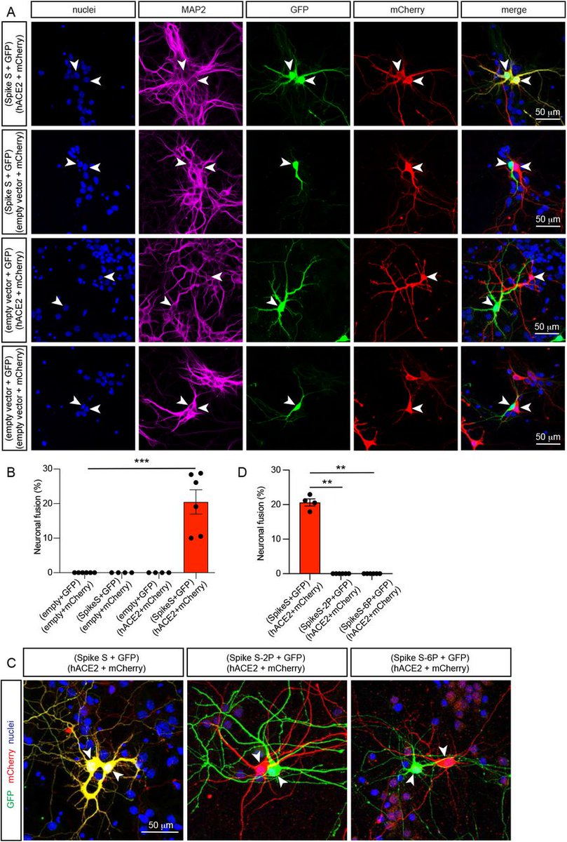 Friday Hope: Quercetin and Curcumin Inhibit Syncytia Formation

Quercetin and Curcumin may prevent and treat the fusion of cells, which appears to be driving sudden cardiac deaths and neurological issues due to the Spike Protein.

wmcresearch.substack.com/p/friday-hope-…