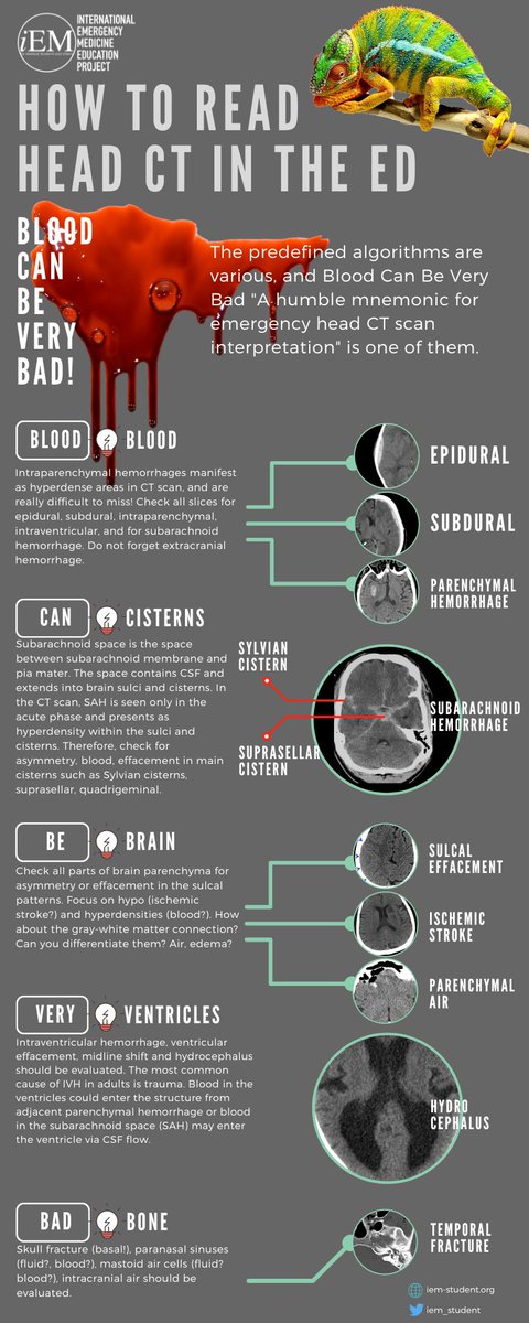 How to read head CT <a href="/IFEM2/">International Federation for Emergency Medicine</a>
