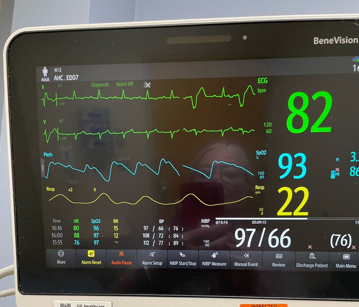 SLamperti's tweet photo. @emupdates I don’t understand what these numbers mean. Would you please? https://t.co/VGoZldmcNH