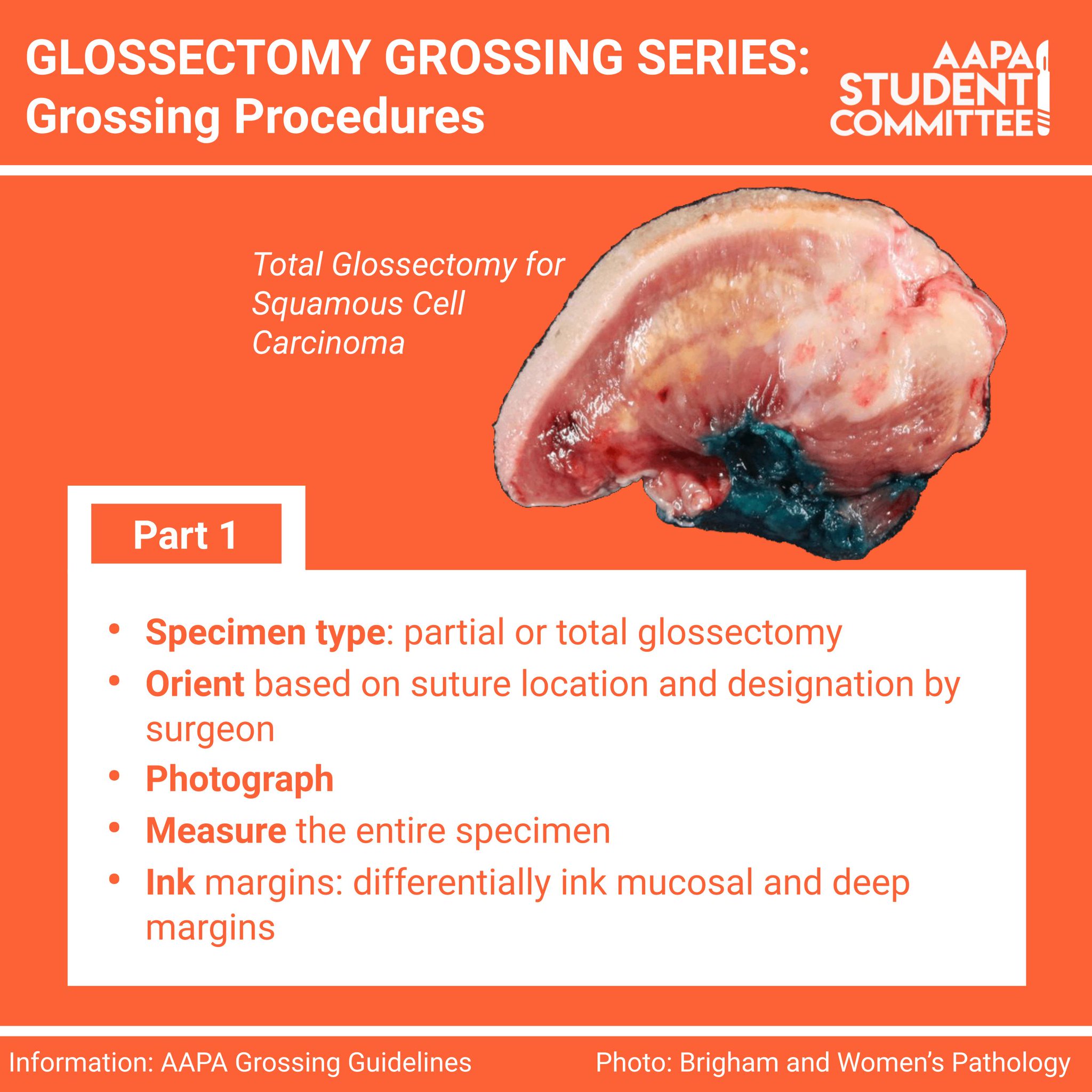 AAPA Students on Twitter "This week, we present grossing procedures