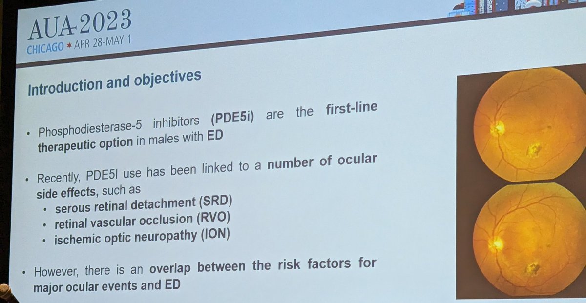 ➡️No increased  risk of intraocular events for men on PDE5i
#AUA2023. <a href="/FedericoBellad1/">Federico Belladelli</a>  <a href="/DrMEisenberg/">Michael Eisenberg</a> <a href="/DonaldDeglover/">Nick Seranio</a>
<a href="/SMSNA_ORG/">SMSNA</a>