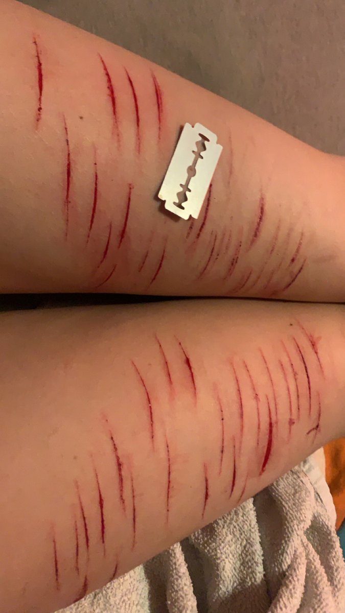 onsu1cidewatch's tweet photo. tiger thighs https://t.co/30ZkvQ5QjF