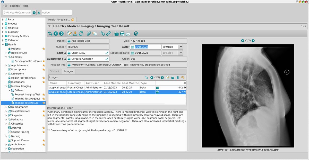 Thymbra_eHealth's tweet image. &quot;Working to deliver the best experience with the #GNUHealth Hospital Management, independently of the device/interface. 
The power of #OpenScience and  cooperation among the #LibreSoftware community&quot; #GNU @gnuhealth @TrytonSoftware  @OrthancServer 
Source: mastodon.social/@gnuhealth/110…