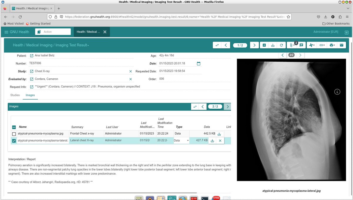 Thymbra_eHealth's tweet image. &quot;Working to deliver the best experience with the #GNUHealth Hospital Management, independently of the device/interface. 
The power of #OpenScience and  cooperation among the #LibreSoftware community&quot; #GNU @gnuhealth @TrytonSoftware  @OrthancServer 
Source: mastodon.social/@gnuhealth/110…