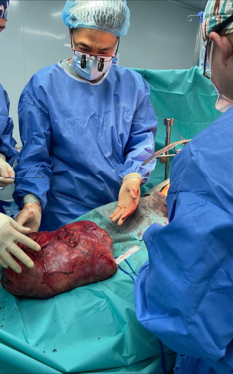 5кг 900гр хавдрыг амжилттай мэс засал хийж эмчилжээ. ✅
Иргэд, ингэтэл нь явдаг бас арай хайхрамжгүй бнаа! ‼️

Бриллиант эмнэлгийн хамт олонд👏👏👏