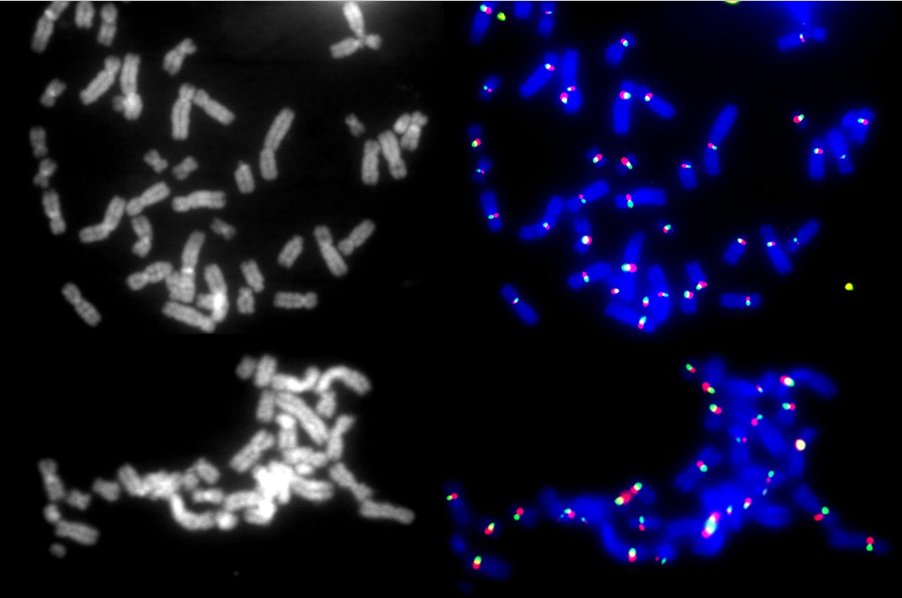 Maria_Narozna's tweet photo. First Cen-CO-FISH exp using forward (red) and reverse (green) probes raised against the CENP-B box sequence on the human iPSCs metaphase spreads 🧬🔬 https://t.co/wBNy98uwVu