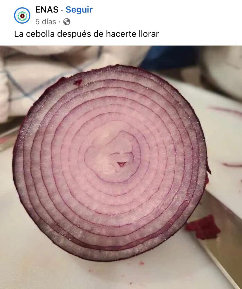 CoronaMinquini's tweet photo. 👩🏼‍⚕️ Después de picar la cebolla 🧅
Me caen mal 😜
.
.
.
#cebolla #mehacellorar #nutriologa #nutricionemocional #nutricion #saludmental #saludemocional #saludmentalyemocional #lanutriemocional #drabuenavibra #psiconutrición #lanutriuniversal #lanutriquenoteprohibe #terapiamareyan https://t.co/4Tk9bzKWIM