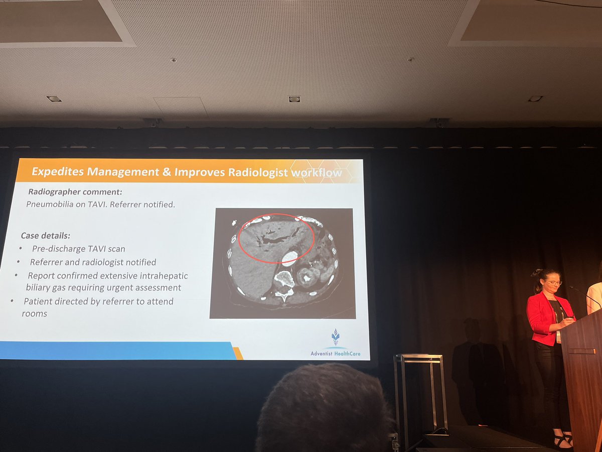 murf1990's tweet photo. Nice proof of concept of radiographer preliminary image evaluation in CT making a difference to patient outcomes by Allie Tonks &amp; Caitlin Tu. #ASMIRT2023 https://t.co/4IJfMyZrFk