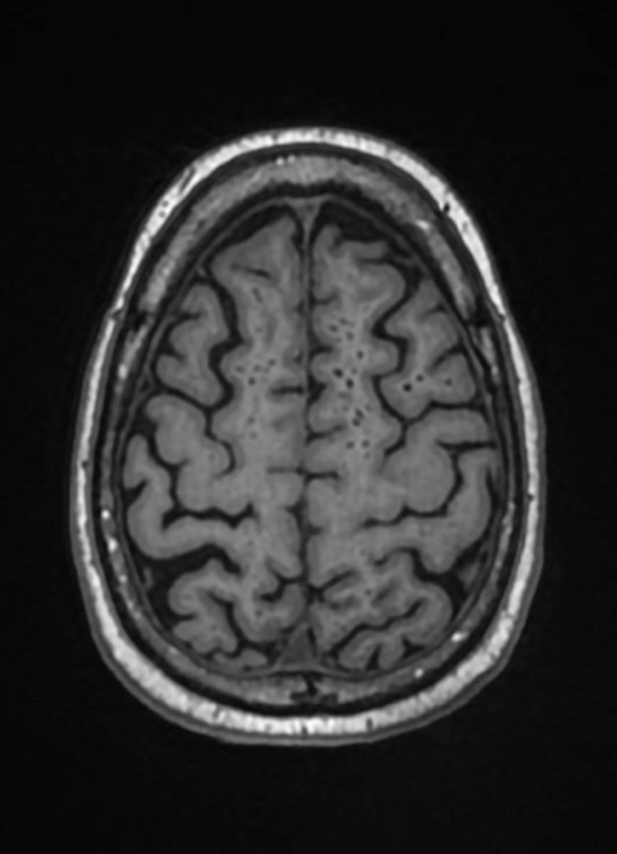 OHSUGeriPsych's tweet photo. https://t.co/CtCJ3Be2C9