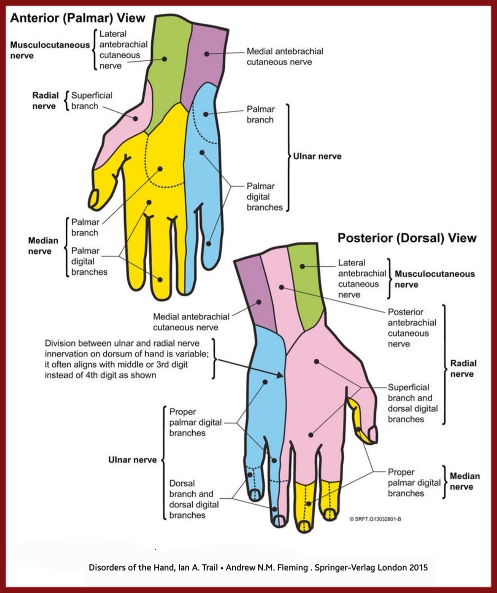 🛑Among the figures and diagrams about the distribution of sensory supply to the hand, I've found this diagram absolutely wonderful and showing in detail the distribution of sensory supply to the hand👍👏👏👏